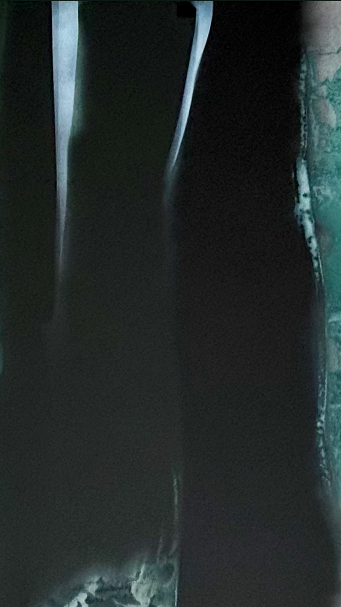 SP264169225
